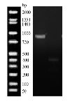 PW1 electrophoresis